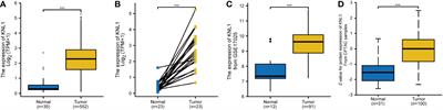 KNL1 is a prognostic and diagnostic biomarker related to immune infiltration in patients with uterine corpus endometrial carcinoma